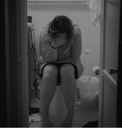 Tratamiento de fisioterapia para incontinencia urinaria